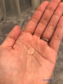 Bộ mỹ phẩm trị mụn Clear Orbis Oil Cut